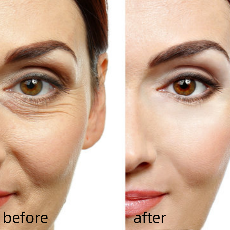 [Dr.Meloxin Official] Cemenrete Calcium Multi Balm | Anti-aging, Sagging, Wrinkles | Korean Cosmetics