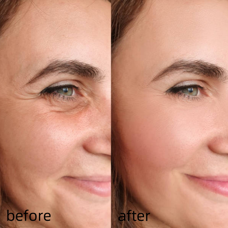 [Dr.Meloxin Official] Cemenrete Calcium Multi Balm | Anti-aging, Sagging, Wrinkles | Korean Cosmetics